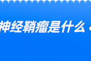 神经鞘瘤是什么,神经鞘瘤有什么症状？