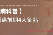 哪些症状和信号需警惕是鼻咽癌？鼻咽癌前期征兆有哪些