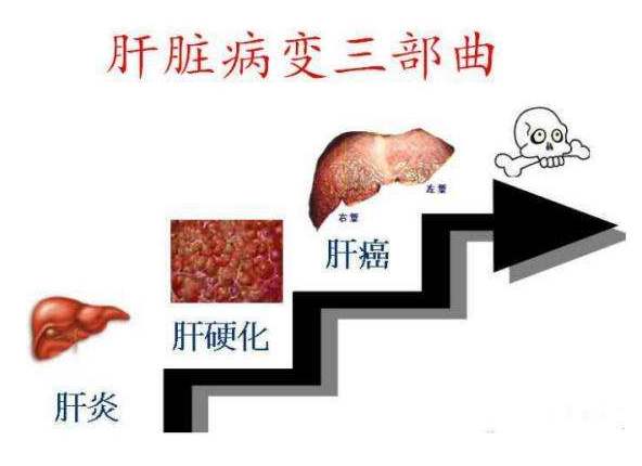 肝癌病变早期症状