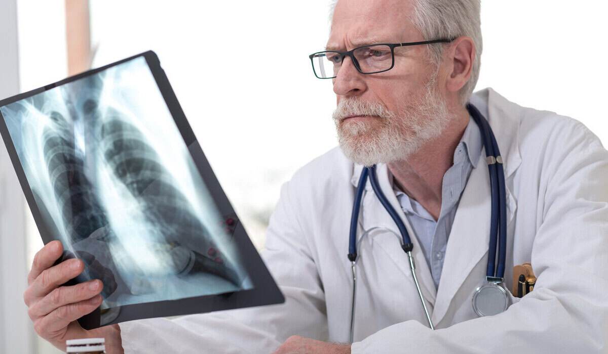 肺癌晚期的症状