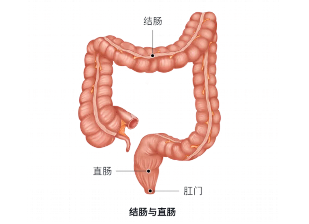 直肠癌与结肠癌的区别