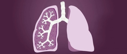 肺癌打化疗后副作用及处理