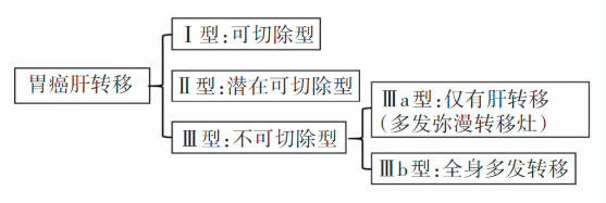 胃癌肝转移分型