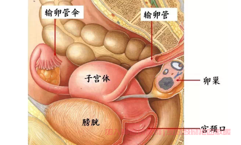 宫颈癌子宫切除手术