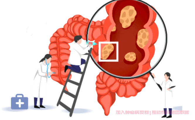 结直肠癌术后并发症怎么办