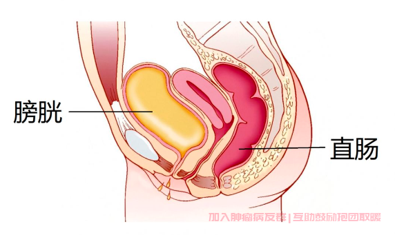 女性膀胱直肠位置示意图