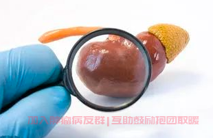 肾癌病友群