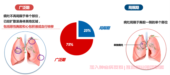 小细胞肺癌临床分期