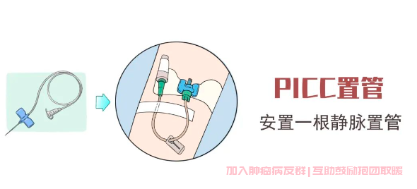 PICC化疗