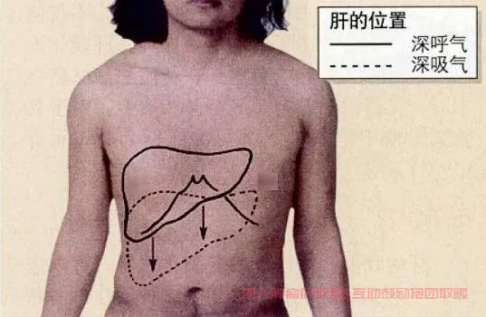 肝癌右肩痛图片