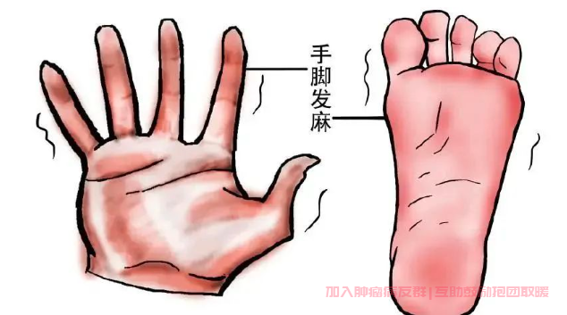化疗后手脚麻