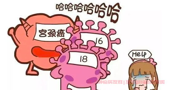 cin是宫颈癌吗