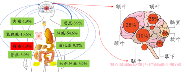 肝癌脑转移