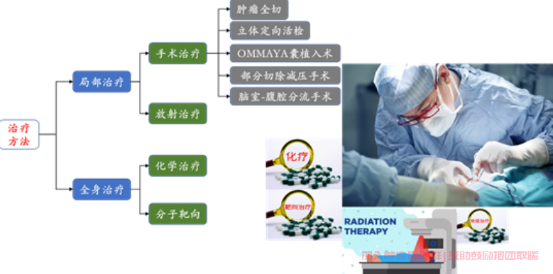 肝癌脑转移治疗