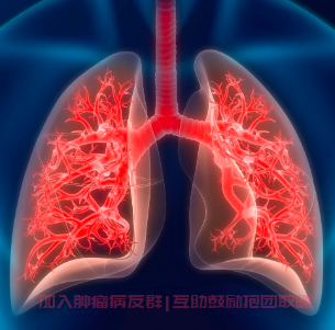 肺癌MET