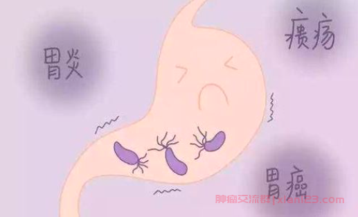 萎缩性胃炎到胃癌多久
