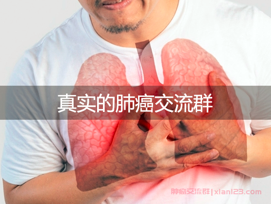 真实的肺癌交流群加入，肺癌交流群之光