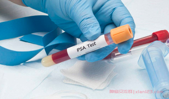 前列腺癌群聊问答：前列腺癌全切后PSA0.6正常吗？