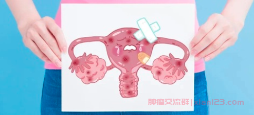 宫颈癌群聊问答：宫颈癌4期B级扩散到淋巴化疗吃不消怎么办？