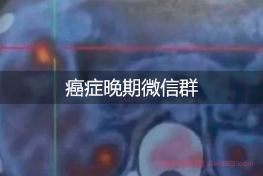 癌症晚期微信群