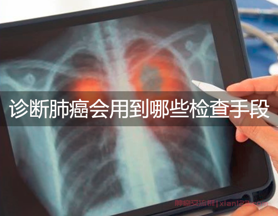 诊断肺癌会用到哪些检查手段