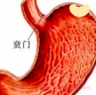 贲门癌化疗后肝功能恢复困难，是否可以考虑其他治疗？