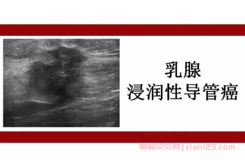 左乳浸润性导管癌2级保乳手术后的治疗方案_乳腺癌群聊疾病问答 左乳浸润性导管癌2级保乳手术后的治疗方案_乳腺癌群聊疾病问答