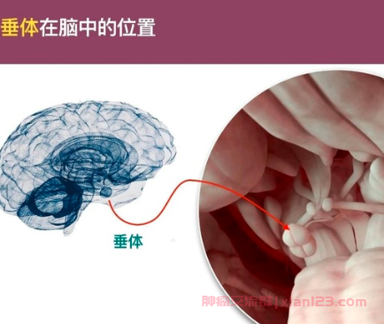 垂体瘤复发，需终止哺乳期并手术切除吗？