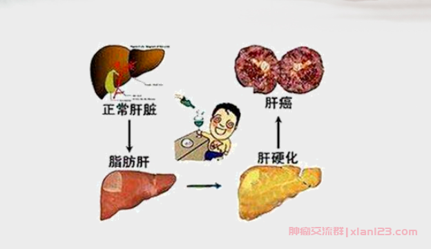 肝癌中晚期患者群,肝癌中晚期患者的故事