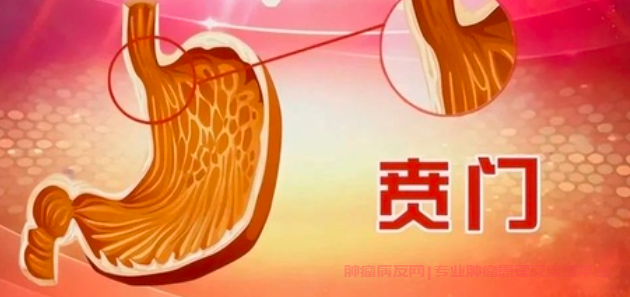 贲门癌聊天群，防范贲门癌的小贴士