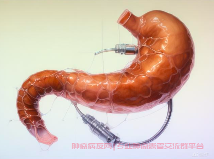 胃镜检查发现食管溃疡，怀疑食管癌该怎么办？