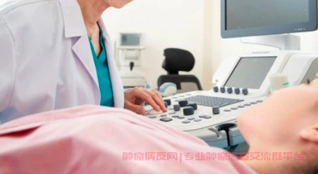 卵巢癌：发现越早，存活率越高_卵巢癌病友资讯