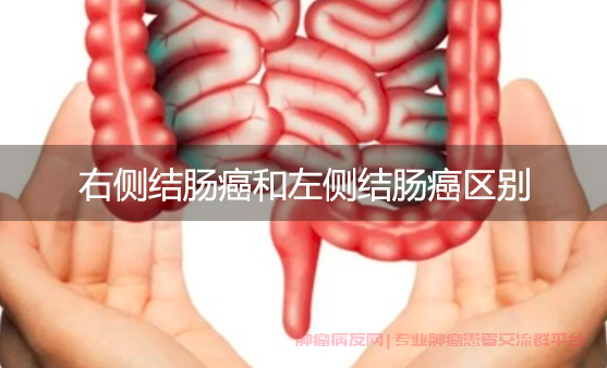 为什么升结肠癌容易贫血的原因,升结肠癌导致贫血的四大机制