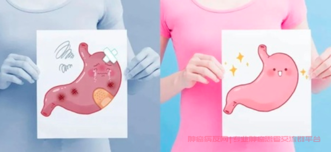胃癌的高危人群有哪些？如何预防胃癌？