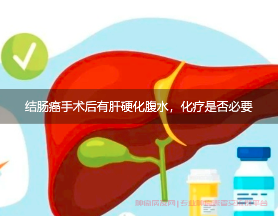 结肠癌手术后有肝硬化腹水，化疗是否必要