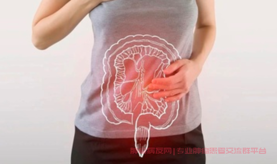 肠癌群聊科普，消化道肿瘤的内镜筛查与治疗
