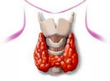 甲状腺微小乳头状癌右侧全切术后6年，TsH现检查是0.9，需要加药吗？