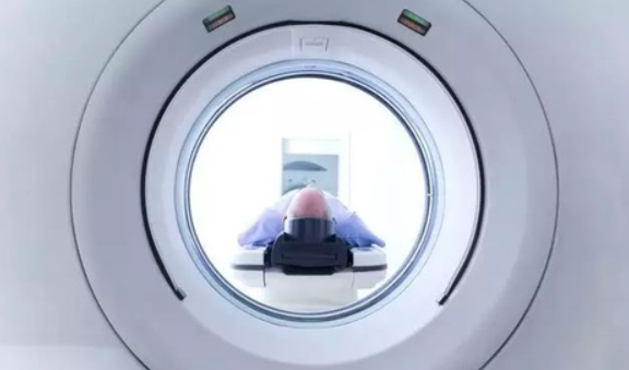 核磁共振能否发现颅内动脉瘤?_脑瘤群聊问答 核磁共振能否发现颅内动脉瘤?_脑瘤群聊问答