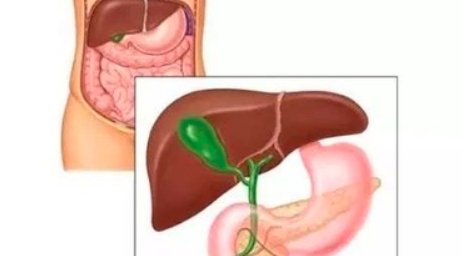 壶腹部癌症群:了解病因、症状与治疗方案 壶腹部癌症群:了解病因、症状与治疗方案