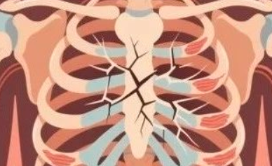 肺癌早期术后CT提示肋骨改变,需要做骨扫描排除骨转移吗? 肺癌早期术后CT提示肋骨改变,需要做骨扫描排除骨转移吗?