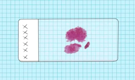 病理切片详解：借阅病理切片的流程与注意事项