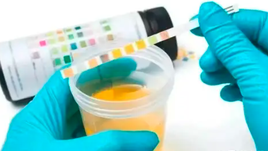 肿瘤患者抽血、B 超、CT、磁共振、PET-CT注意事项,提高检查效率 肿瘤患者抽血、B 超、CT、磁共振、PET-CT注意事项,提高检查效率