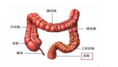  直肠癌低分化腺癌群问答，加入我们倾诉心声互相鼓励