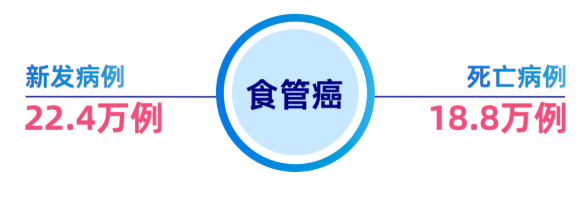 食管癌防治指南：了解危险因素、高危人群与科学筛查，守护“生命通道”