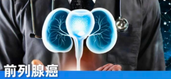 前列腺癌科学防治指南:了解风险、筛查与预防,守护男性健康 前列腺癌科学防治指南:了解风险、筛查与预防,守护男性健康