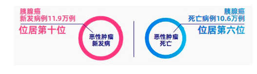 2022年中国胰腺癌数据:危险因素、高危人群与早期筛查全指南 2022年中国胰腺癌数据:危险因素、高危人群与早期筛查全指南