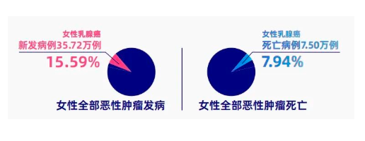 科学防癌科普：乳腺癌的流行病学、风险因素、筛查与预防指南