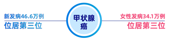 甲状腺癌科普：2022年中国新发46.6万例，高危人群与筛查预防指南