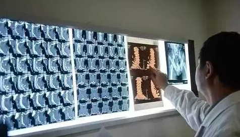 医院检查有辐射?B超、核磁、CT、X光辐射真相科普,告别盲目恐慌 医院检查有辐射?B超、核磁、CT、X光辐射真相科普,告别盲目恐慌