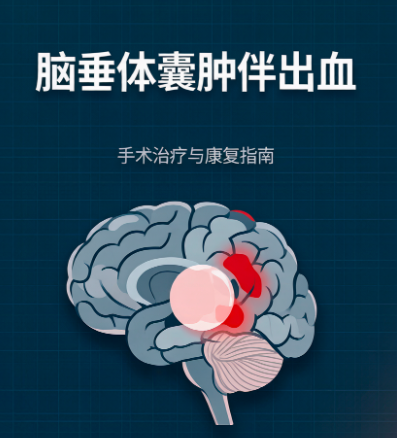 脑垂体囊肿伴出血怎么治？一年半隐痛，保守观察还是手术？神经外科专家解读